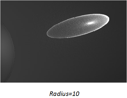 Radius10.png